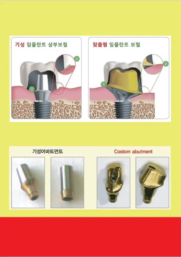 루미네이트 임상사례집 수록 이미지 55